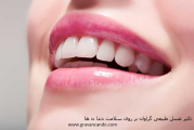 بررسی خراب شدن دندان ها و تاثیر مصرف عسل بر سلامت دندان ها و لثه