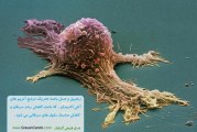 ۱۱ خاصیت حیرت انگیز عسل و زنجبیل را باید بدانید(۲)؟